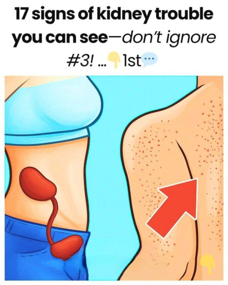 618134085 122119455081020856 443875468796251459 n