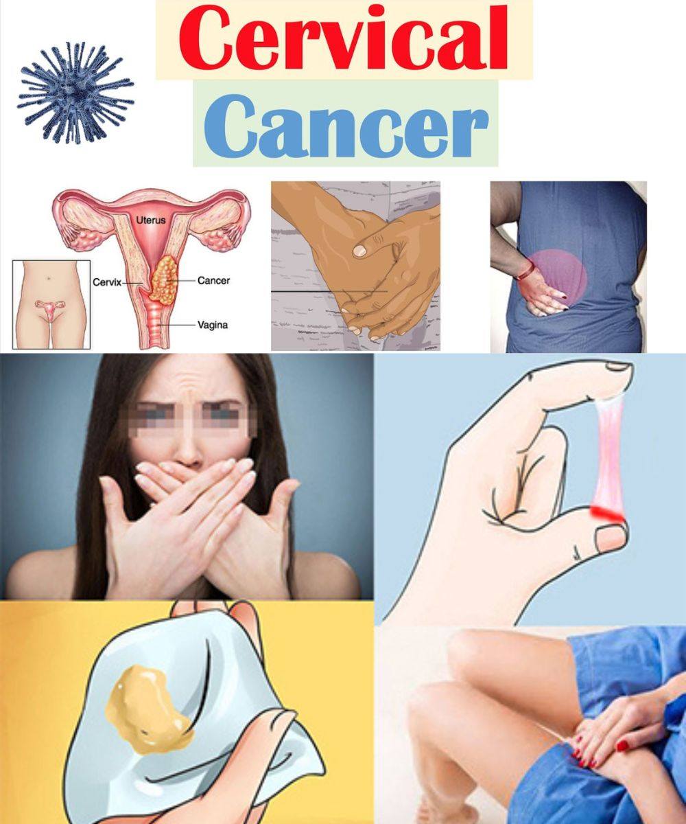 12 Early Signs Your Uterus May Be Asking for Help – Don’t Overlook These Signals 623945811 2490782207990804 3128498187912109461 n